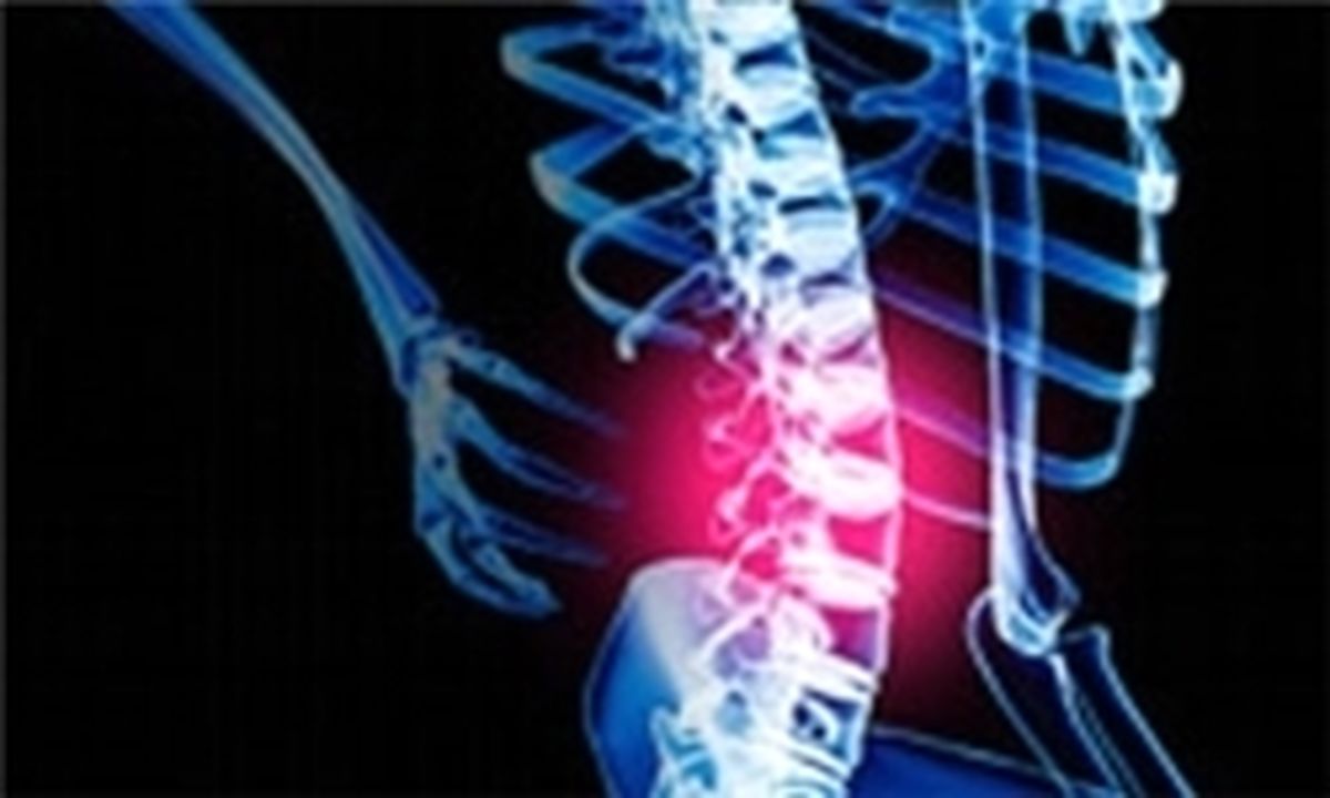 جدیدترین روش درمان کمردرد را بشناسید