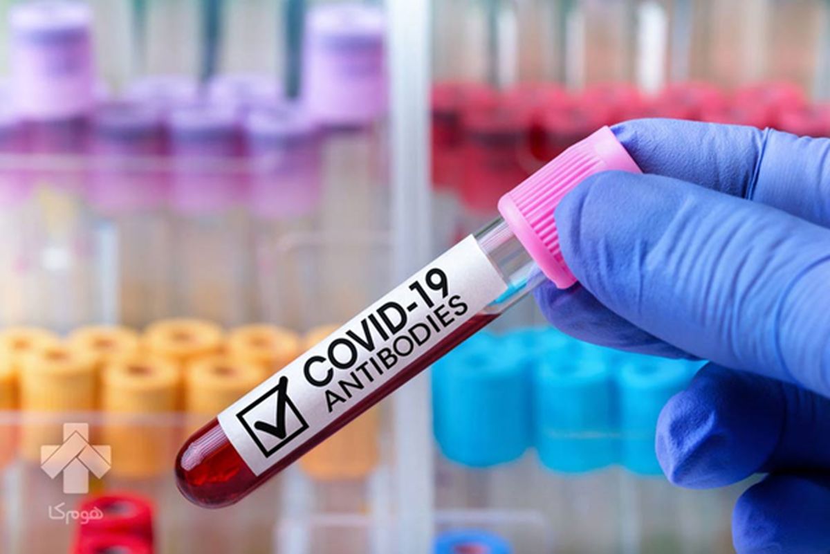 تست کرونا در منزل غرب تهران