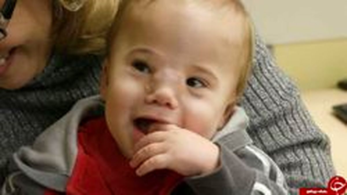 بیماری عجیب کودکی که پزشکان را به چالش کشید! +عکس