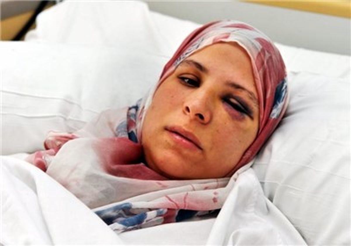 چادری مضروب به جرم نهی ازمنکر/عکس