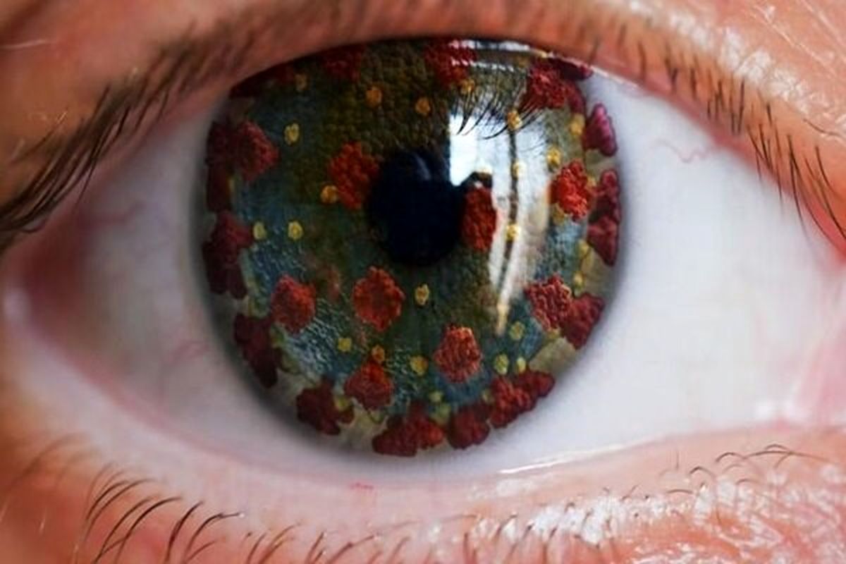علایم کرونای چشمی را جدی بگیرید