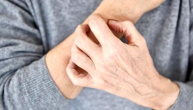 خارش بی‌دلیل پوست را جدی بگیرید