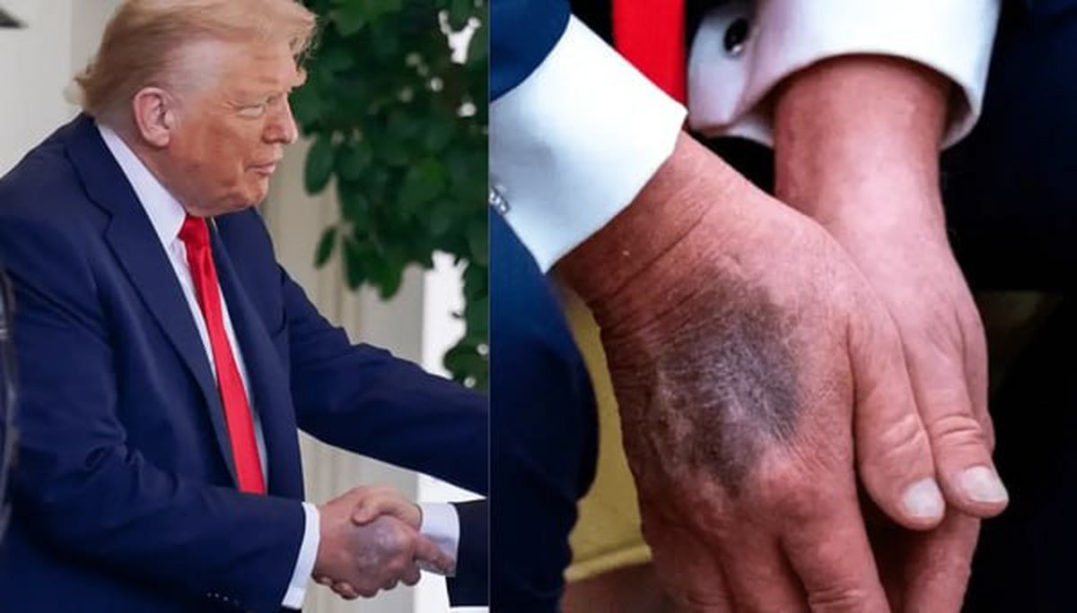 معاینه ترامپ در بیمارستان نظامی؛ کاخ سفید: کاملا سالم است