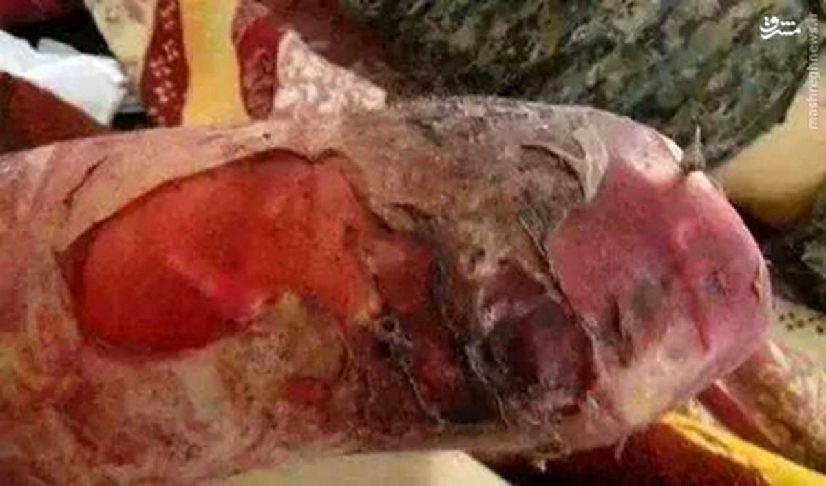 عکس/حملهشیمیاییداعشبهکوبانی+18