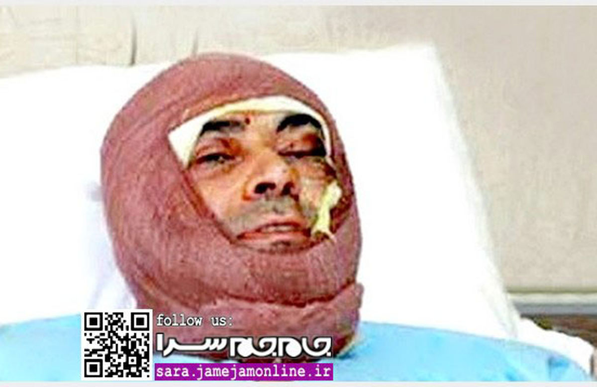 دکتر انوری بعد از اسیدپاشی/تصاویر