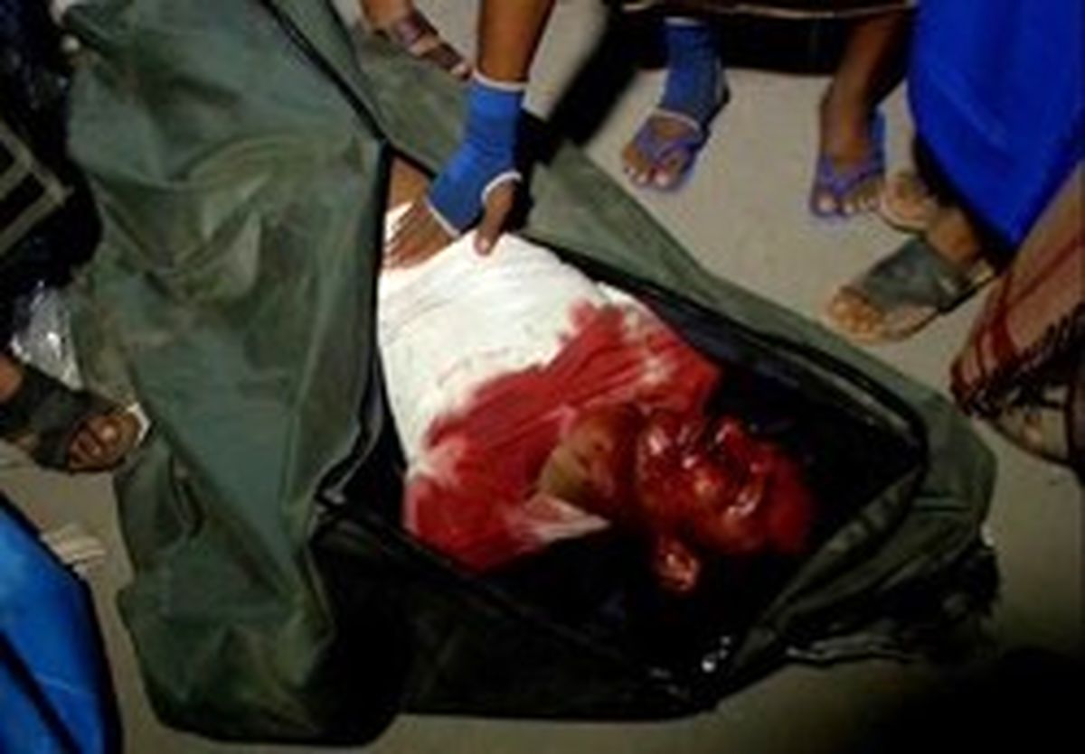 دنیا از دور نظاره‌گر بحرانی دراماتیک در یمن است