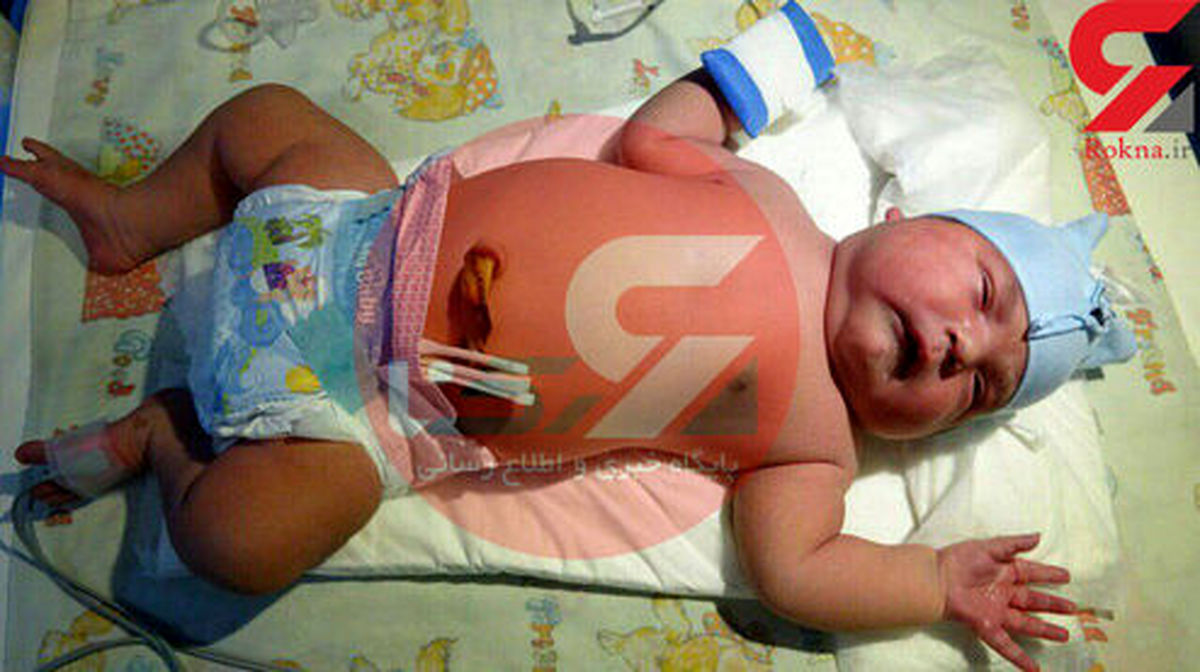 هرکول دختر در میاندوآب به دنیا آمد +عکس