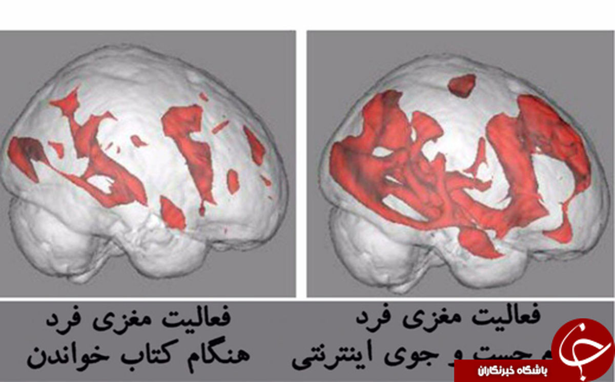 آیا میدانید؛ اینترنت با مغزتان چه می‌کند؟