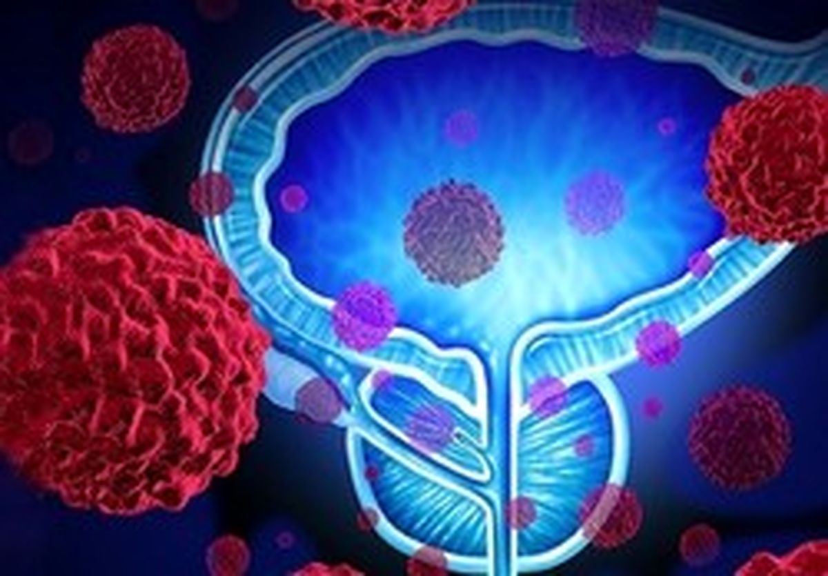 علائم هشدار دهنده سرطان را جدی بگیرید