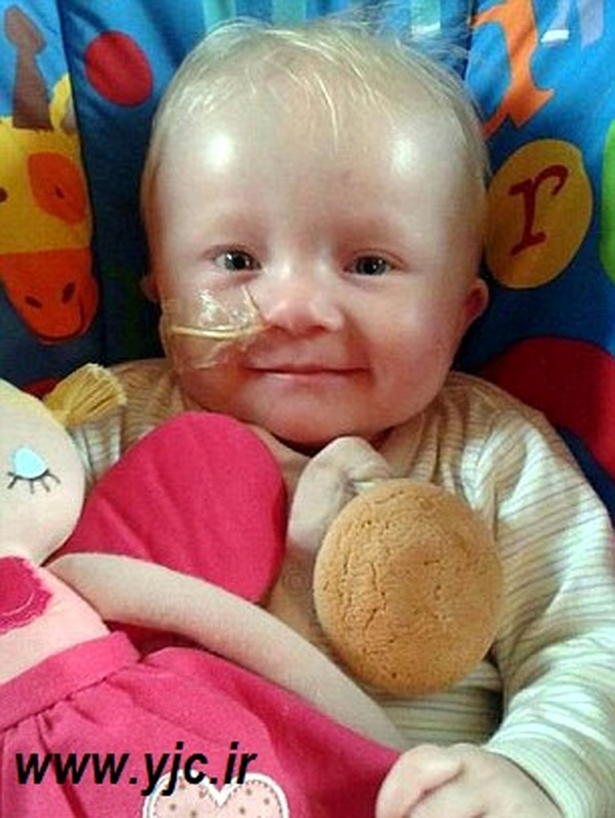 کودکی با نادرترین بیماری دنیا /عکس